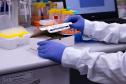 Com apoio do Estado, a startup curitibana Hyla Biotech criou um kit de diagnóstico rápido de câncer de mama dentro da Fundação Oswaldo Cruz (Fiocruz).